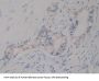 Insulin Like Growth Factor 1 (IGF1) Antibody
