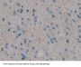 Insulin Like Growth Factor 1 (IGF1) Antibody