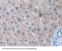 Matrix Metalloproteinase 15 (MMP15) Antibody