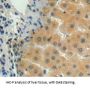 Matrix Metalloproteinase 15 (MMP15) Antibody