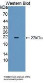Sex Hormone Binding Globulin (SHBG) Antibody