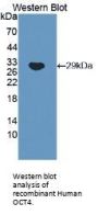 POU Class 5 Homeobox 1 / OCT4 (POU5F1) Antibody
