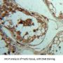Parathyroid Hormone Receptor 2 (PTHR2) Antibody