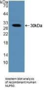 Nucleoporin 50 kDa (NUP50) Antibody