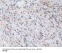 Nucleoporin 50 kDa (NUP50) Antibody