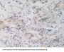 Nucleoporin 50 kDa (NUP50) Antibody