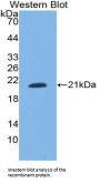 Small Nuclear Ribonucleoprotein Polypeptide C (SNRPC) Antibody