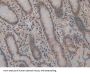 Basigin (BSG) Antibody