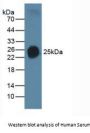 Pulmonary Surfactant-Associated Protein C (SFTPC) Antibody