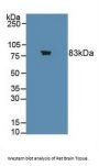 Choline Acetyltransferase (ChAT) Antibody