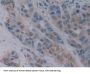 Choline Acetyltransferase (ChAT) Antibody