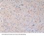 HLA Class I Histocompatibility Antigen, C Alpha Chain (HLA-C) Antibody