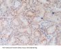 HLA Class I Histocompatibility Antigen, C Alpha Chain (HLA-C) Antibody