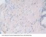 HLA Class I Histocompatibility Antigen, C Alpha Chain (HLA-C) Antibody