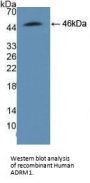 Adhesion Regulating Molecule 1 (ADRM1) Antibody