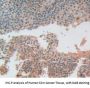 Adhesion Regulating Molecule 1 (ADRM1) Antibody