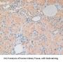 Adhesion Regulating Molecule 1 (ADRM1) Antibody