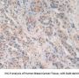 Adhesion Regulating Molecule 1 (ADRM1) Antibody