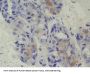 Calcyphosine (CAPS) Antibody