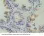 Calcyphosine (CAPS) Antibody