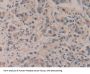 Amyloid Beta Precursor Protein Binding Protein A2 (APBA2) Antibody