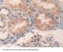 Protein Kinase, AMP Activated alpha 2 Antibody