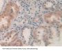 Protein Kinase, AMP Activated alpha 2 Antibody