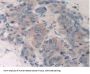 Cytochrome P450 26A1 (CYP26A1) Antibody