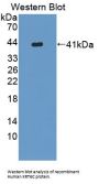 Keratin 6C (KRT6C) Antibody
