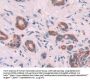 Keratin 6C (KRT6C) Antibody