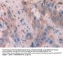 Keratin 6C (KRT6C) Antibody