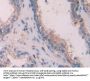 Keratin 6C (KRT6C) Antibody