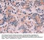 Keratin 6C (KRT6C) Antibody