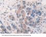 Suppressors of Cytokine Signaling 2 (SOCS2) Antibody