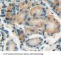 Suppressors of Cytokine Signaling 2 (SOCS2) Antibody