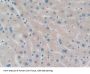 Protein Phosphatase, Mg2+/Mn2+ Dependent 1A (PPM1A) Antibody