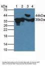 Fructosamine-3-Kinase (FN3K) Antibody