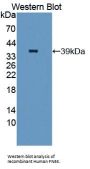 Fructosamine-3-Kinase (FN3K) Antibody