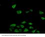 Fructosamine-3-Kinase (FN3K) Antibody