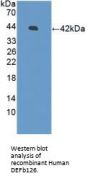 Defensin Beta 126 (DEFb126) Antibody