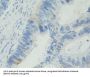 Basal Cell Adhesion Molecule (BCAM) Antibody