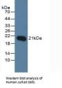 O-6-Methylguanine DNA Methyltransferase (MGMT) Antibody