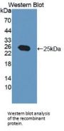 O-6-Methylguanine DNA Methyltransferase (MGMT) Antibody