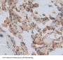 Laminin Gamma 3 (LAMC3) Antibody