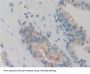 G Protein Coupled Receptor Kinase 6 (GRK6) Antibody