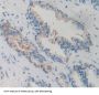 G Protein Coupled Receptor Kinase 6 (GRK6) Antibody