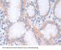 Catenin Alpha 1 (CTNNa1) Antibody