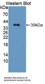 Survival of Motor Neuron 1, Telomeric (SMN1) Antibody