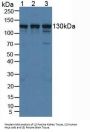 Huntingtin Interacting Protein 12 (HIP12) Antibody