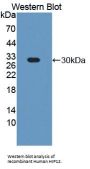Huntingtin Interacting Protein 12 (HIP12) Antibody